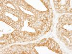 EPS15 Antibody in Immunohistochemistry (Paraffin) (IHC (P))