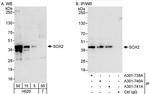 SOX2 Antibody in Western Blot (WB)