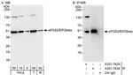 eIF2beta/EIF2S2 Antibody in Western Blot (WB)