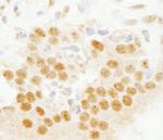 SET7 Antibody in Immunohistochemistry (Paraffin) (IHC (P))