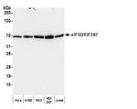 eIF3D/EIF3S7 Antibody in Western Blot (WB)