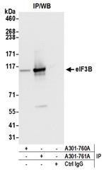 eIF3B/EIF3S9 Antibody in Immunoprecipitation (IP)