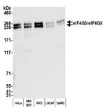 eIF4G3/eIF4GII Antibody in Western Blot (WB)