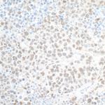 PHF8 Antibody in Immunohistochemistry (Paraffin) (IHC (P))