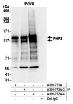 PHF8 Antibody in Immunoprecipitation (IP)