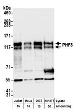 PHF8 Antibody in Western Blot (WB)