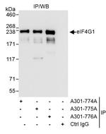 eIF4G1/eIF4GI Antibody in Immunoprecipitation (IP)