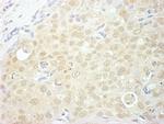 NCBP1/CBP80 Antibody in Immunohistochemistry (Paraffin) (IHC (P))