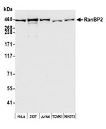 RanBP2 Antibody in Western Blot (WB)