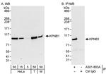 KPNB1 Antibody in Western Blot (WB)