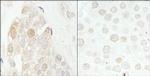 CDK2 Antibody in Immunohistochemistry (Paraffin) (IHC (P))