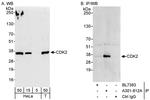 CDK2 Antibody in Western Blot (WB)