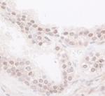 JARID1B Antibody in Immunohistochemistry (Paraffin) (IHC (P))