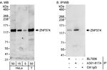 ZNF574 Antibody in Western Blot (WB)