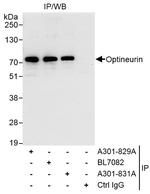 Optineurin Antibody in Immunoprecipitation (IP)