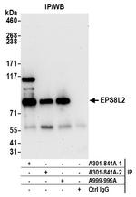 EPS8L2 Antibody in Immunoprecipitation (IP)