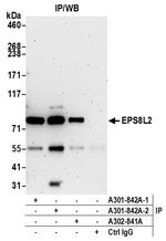 EPS8L2 Antibody in Immunoprecipitation (IP)