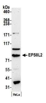 EPS8L2 Antibody in Western Blot (WB)