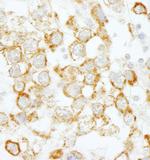 eIF4H Antibody in Immunohistochemistry (Paraffin) (IHC (P))