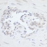 RPC2 Antibody in Immunohistochemistry (Paraffin) (IHC (P))