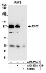 RPC2 Antibody in Immunoprecipitation (IP)