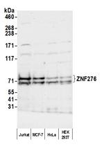 ZNF276 Antibody in Western Blot (WB)