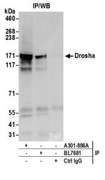 Drosha Antibody in Immunoprecipitation (IP)