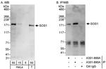 SOS1 Antibody in Western Blot (WB)