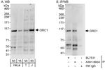 ORC1 Antibody in Western Blot (WB)