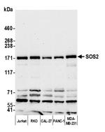 SOS2 Antibody in Western Blot (WB)