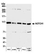 Notch1 Antibody in Western Blot (WB)