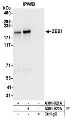 ZEB1 Antibody in Immunoprecipitation (IP)