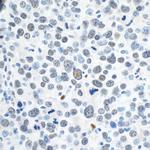 ZEB1 Antibody in Immunohistochemistry (Paraffin) (IHC (P))