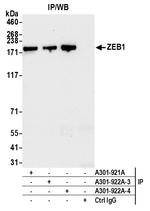 ZEB1 Antibody in Immunoprecipitation (IP)