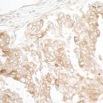 GEF-H1 Antibody in Immunohistochemistry (Paraffin) (IHC (P))