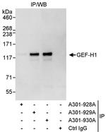 GEF-H1 Antibody in Immunoprecipitation (IP)