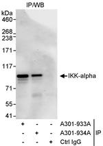 IKK-alpha Antibody in Immunoprecipitation (IP)