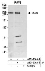 Dicer Antibody in Immunoprecipitation (IP)