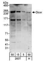 Dicer Antibody in Western Blot (WB)