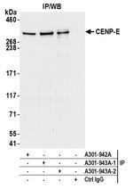 CENP-E Antibody in Immunoprecipitation (IP)