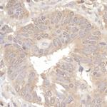 eIF2A Antibody in Immunohistochemistry (Paraffin) (IHC (P))