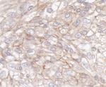 IQGAP1 Antibody in Immunohistochemistry (Paraffin) (IHC (P))