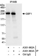 GBF1 Antibody in Immunoprecipitation (IP)