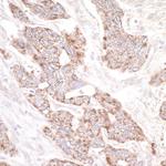 PDZ-GEF1 Antibody in Immunohistochemistry (Paraffin) (IHC (P))