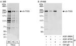 ch-TOG Antibody in Western Blot (WB)