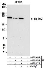 ch-TOG Antibody in Immunoprecipitation (IP)