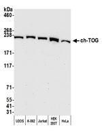 ch-TOG Antibody in Western Blot (WB)