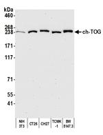 ch-TOG Antibody in Western Blot (WB)