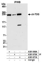 ch-TOG Antibody in Immunoprecipitation (IP)