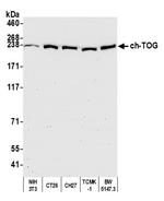 ch-TOG Antibody in Western Blot (WB)